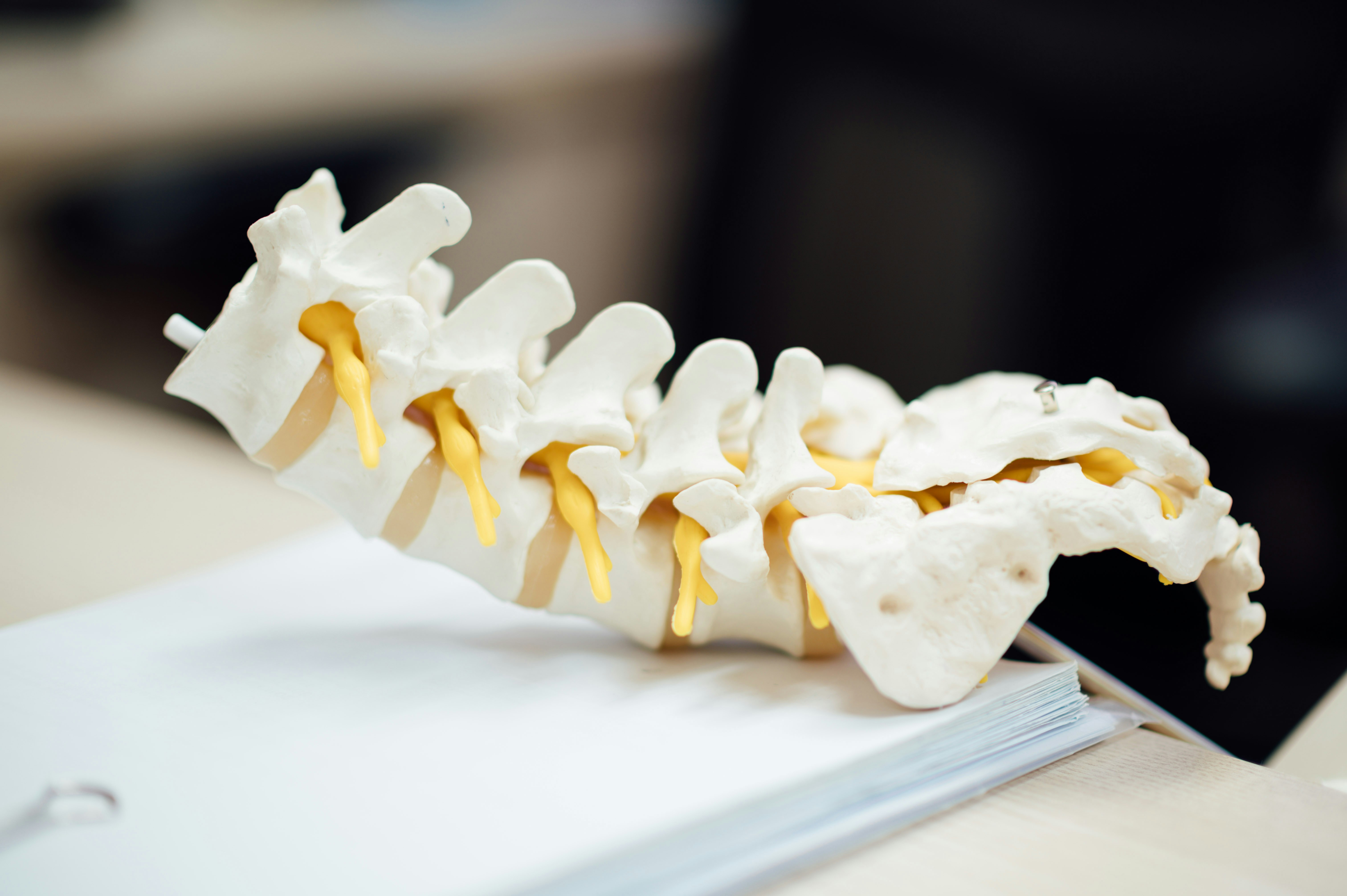 Spinal model representing chiropractic care that reduces the need for back surgery